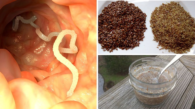 olcsó gyógyszerparazitáktól hogyan lehet megszüntetni a pinworm parazitákat a gyermekeknél