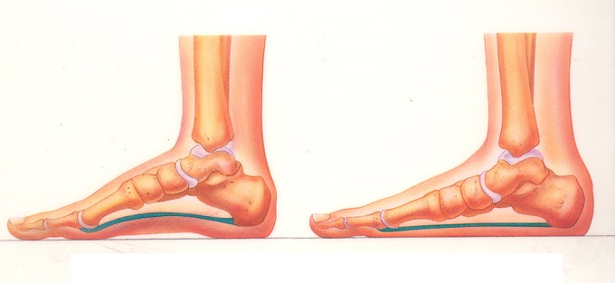 artroza kostiju tretman stopala)