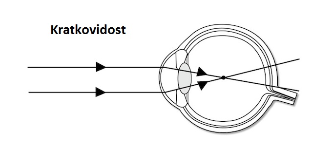 Очки с глазами. Close sighted. Коллиматорный прицел окп-7. Технологичный глаз. Проблемы со зрением.